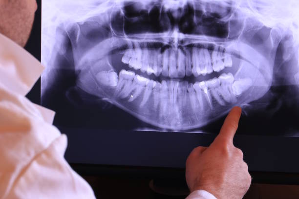 Best Weekend Emergency Dentist in Shiremanstown, PA
